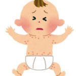 食物アレルギーの赤ちゃんの湿疹はいつ消えるの？対処法と除去法を紹介！